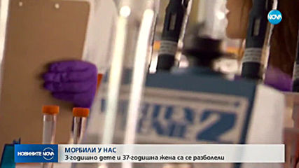 Морбили у нас: 3-годишно дете и 37-годишна жена са се разболели