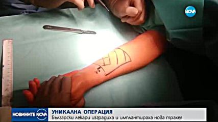 УНИКАЛНА ОПЕРАЦИЯ: Български лекари изградиха и имплантираха нова трахея