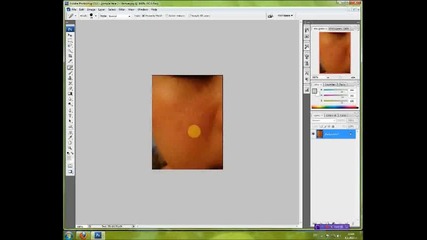 Как да премахваме пъпки и други кожни инфекции с помощта на Adobe Photoshop Cs3 