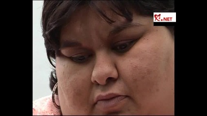 240 килограмова Румънка роди с цезарово сечение 