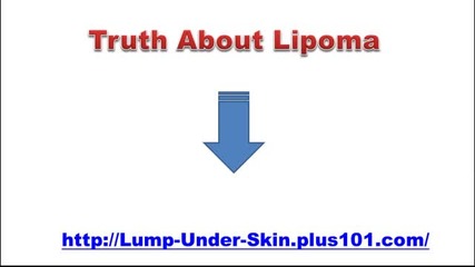 Cost Of Lipoma Removal