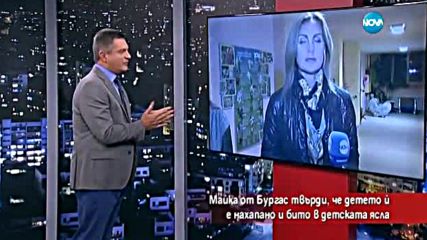 Майка твърди, че детето й било нахапано в детската ясла