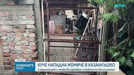 Какво е състоянието на детето, нападнато от Кане Корсо