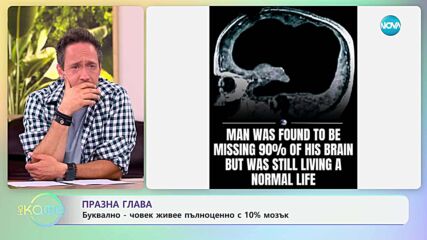 Празна глава: Буквално - човек живее пълноценно с 10 % мозък - „На кафе” (08.07.2025)