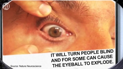 10 неща, които не знаете за очите си - All time 10s