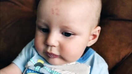 Бебе се роди с 12-ица на челото!