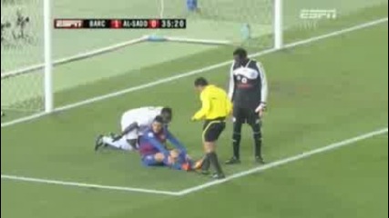 David Villa breaks leg in Club World Cup match