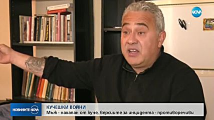 Мъж бе нахапан от куче, версиите за инцидента са противоречиви