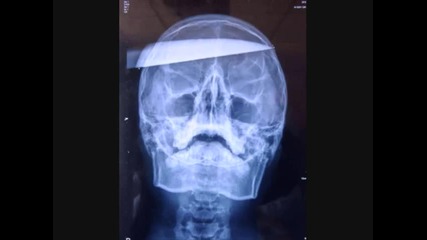 Dub-rex - Stab Ya Brain !