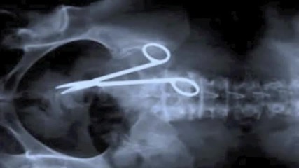 25 Необичайни Неща Открити При Рентгенография