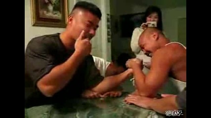Ужасно Счупи Му Се Ръката