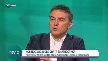 Проф. Иво Петров: Термокамерата помага за скрининг на съдовите заболявания