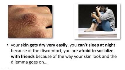 14 Days Eczema Cure - The Safe And Natural Way To Cure Eczema 