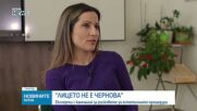 "Лицето не е чернова" - експерти с кампания за рисковете от естетичните процедури