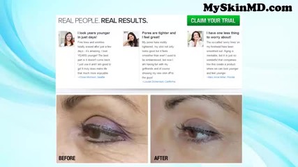 Nuvalift Review - Want To Erase Wrinkles Totally? Try Nuvalift Anti Aging Complex