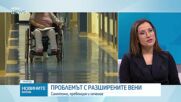 Д-р Владо Галчев: Жегата влияе на кръвоносните съдовете, не пренебрегвайте симптомите