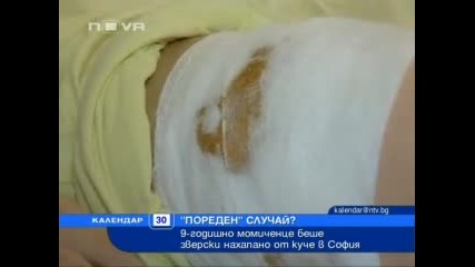 Момиченце беше зверски нахапано от куче