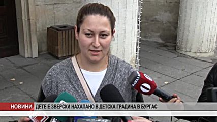 Дете е зверски нахапано в детска градина в Бургас
