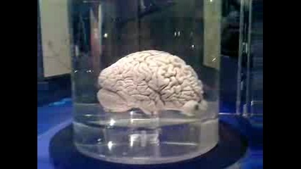 Човешкият Мозък