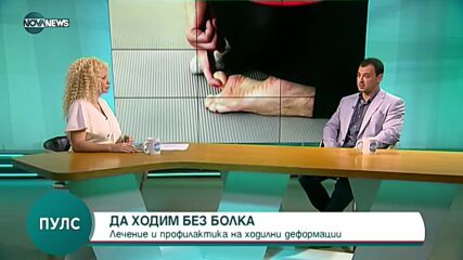 Ортопед: Обърнете внимание на стъпалата си при спадане на свода на ходилото