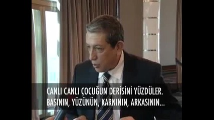 ermeni doktor canli canli 13 yasingadi cocugu derisini yuzdu 13
