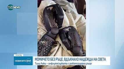 Тили Локи – инфлуенсърката с роботизирани ръце, която отлепя етикета „различен”