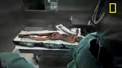Аутопсия на замръзнал умрял човек