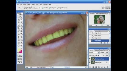 Оправете Зъбите Си На Phоtoshop 2