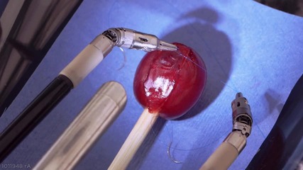Хирургически робот прецизно зашива зрънце от грозде