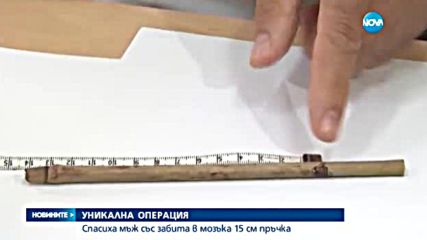 УНИКАЛНА ОПЕРАЦИЯ: В Плевен спасиха мъж с 15-сантиметрова пръчка в мозъка