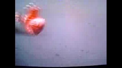 Destroyed in Seconds_ Bike Accident