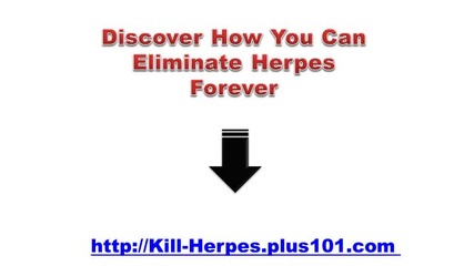 How To Get Rid Of Hsv 1