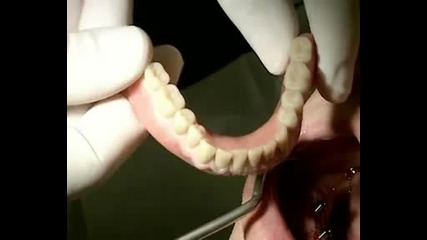 как се създава зъбен имплантант