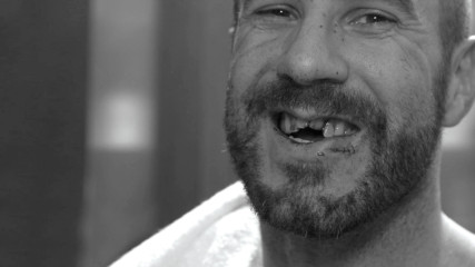 Cesaro receives stitches ahead of emergency dental work: WWE.com Exclusive, Sept. 24, 2017