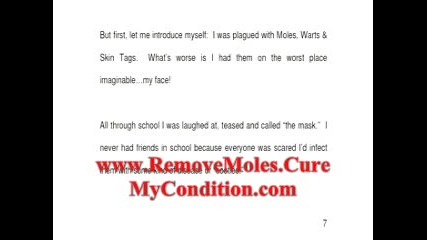 Are Moles and Skin Tags removable permanently? Learn how to remove them