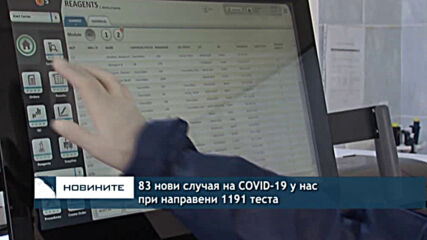 83 нови случая на COVID-19 у нас при направени 1191 теста