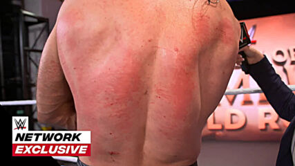Drew McIntyre shows off Ambulance Match battle wounds: WWE Network Exclusive, Sept. 27, 2020