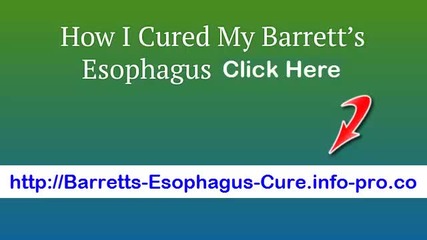 Barrett's Esophagus Icd 9, Barrett's Esophagus Foods To Avoid, Barrett's Esophagus Cough