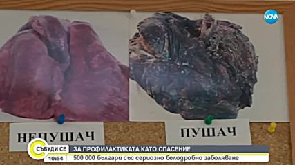 500 000 българи със сериозно белодробно заболяване