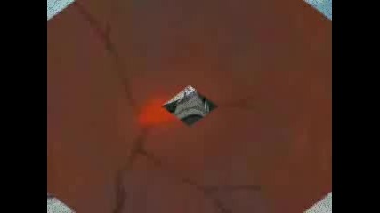 Sasuke vs Naruto Duels - Broken