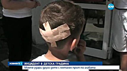 Дете - с рана на главата след инцидент в детска градина