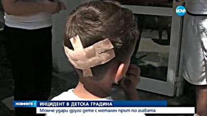 Дете - с рана на главата след инцидент в детска градина