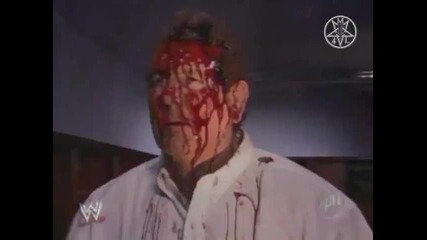 Ренди се шокира от кървавото лице на баща си