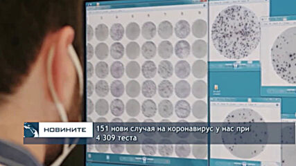151 нови случая на коронавирус у нас при 4 309 теста