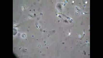 Сперма Под Микроскоп