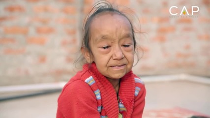 Историята, която разплака милиони по цял свят: Нелечима болест превръща децата в старци