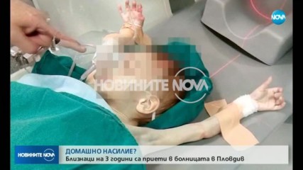 ДОМАШНО НАСИЛИЕ? Близначета са в болница в Пловдив със синини и кръвоизливи