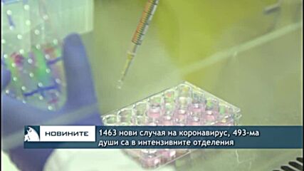 1463 нови случая на коронавирус, 493-ма души са в интензивните отделения
