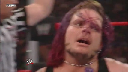 Jeff Hardy vs. Chris Jericho - Intercontinental Title Match