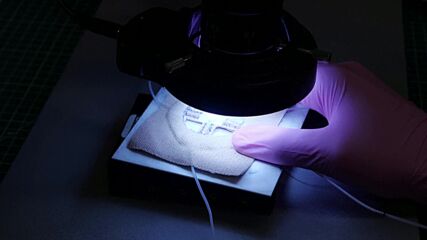 Учени изобретиха начин за 3D принтиране директно в човешкото тяло (ВИДЕО)